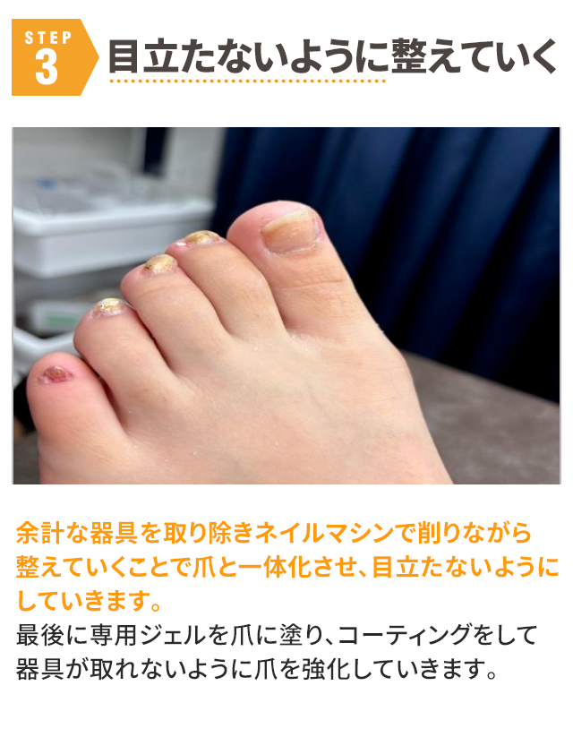 STEP3